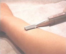 We carefully shave the region that 
	is to be treated.