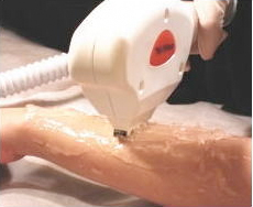 Since we use the latest hair removal 
	equipment, the hair removal will be complete.